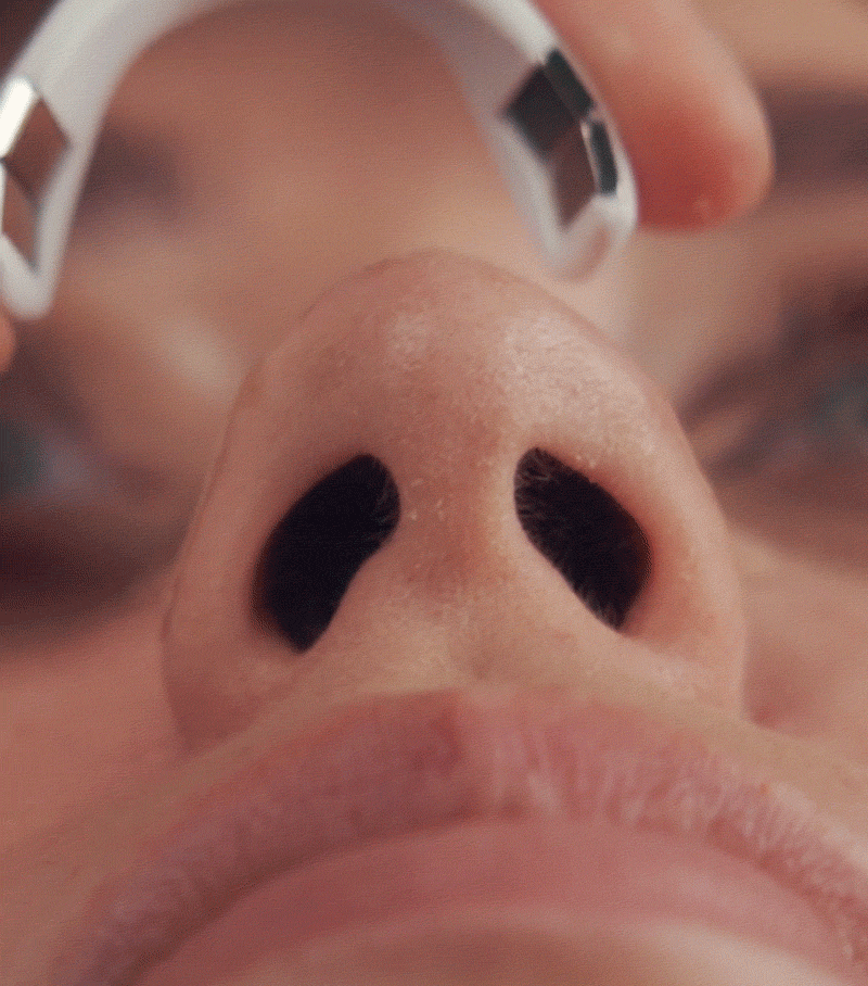 Adline MagAir™ Premium Magnetic Nasal Dilator